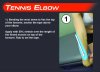 tenniselbow.jpg